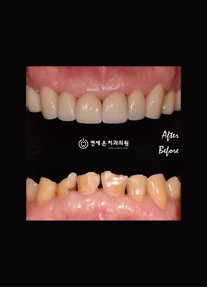 치료후기를 보시려면 회원가입이 필요합니다.