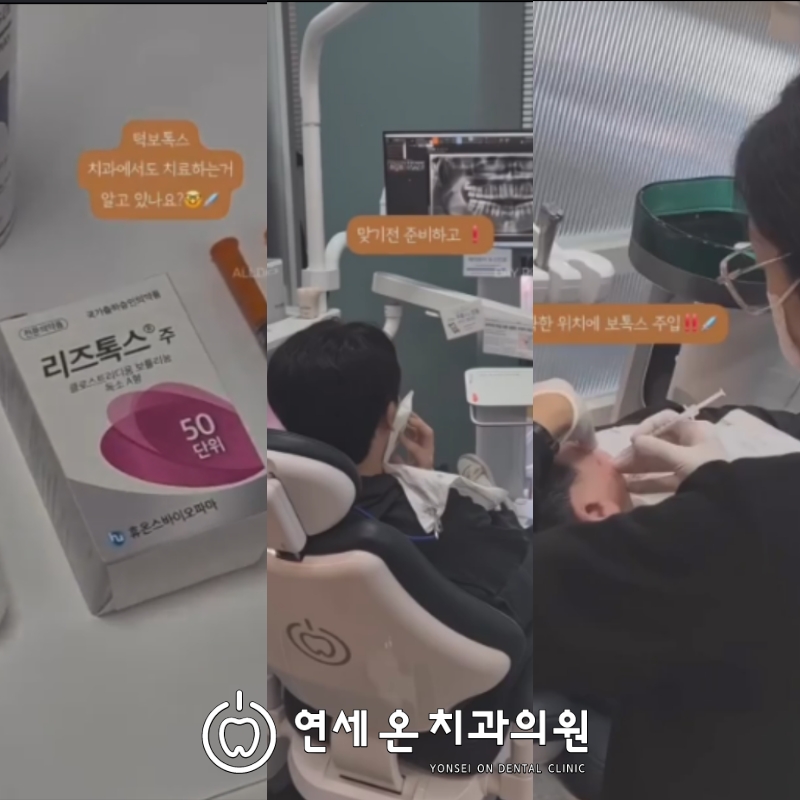 교근보톡스